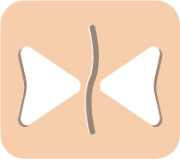 Επιθηλιοποίηση